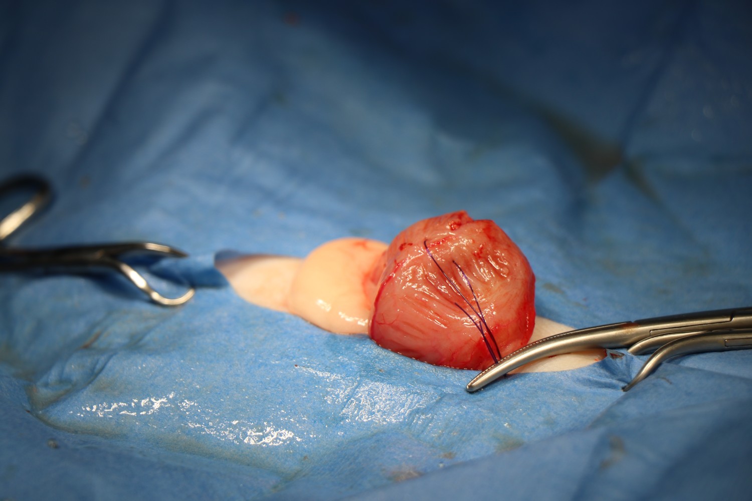 Cystotomy & Urethrostomy